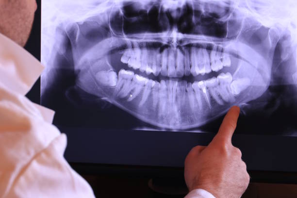 Best Emergency Dental Care for Abscessed Tooth in Clifton, TX